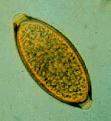 Clicca sull'immagine per ingrandirla.&nbsp;

Nome:   trichuris_egg.jpg&nbsp;
Visite: 1342&nbsp;
Dimensione: 4.0 KB&nbsp;
ID: 2138166